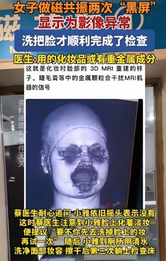 解释不清了！福建一29岁女生头晕，去医院做头颅磁共振。不料，连续2次扫描，都