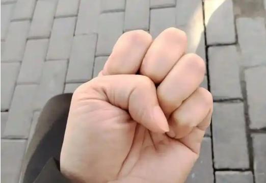 液病患者的调理方法，每天握拳一分钟，血指标越来越好！随时随地都能做，不管你是哪