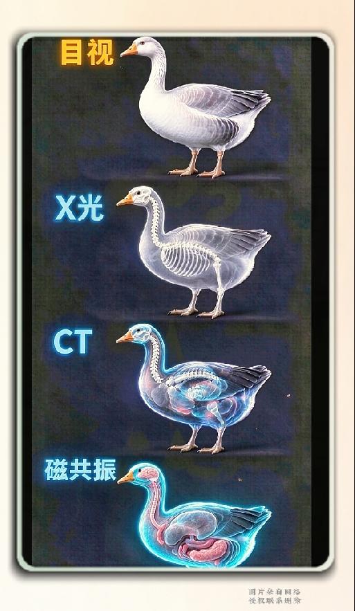 一张大白鹅图解，看懂X光、CT、磁共振到底差在哪很多人去医院做检查，总搞不