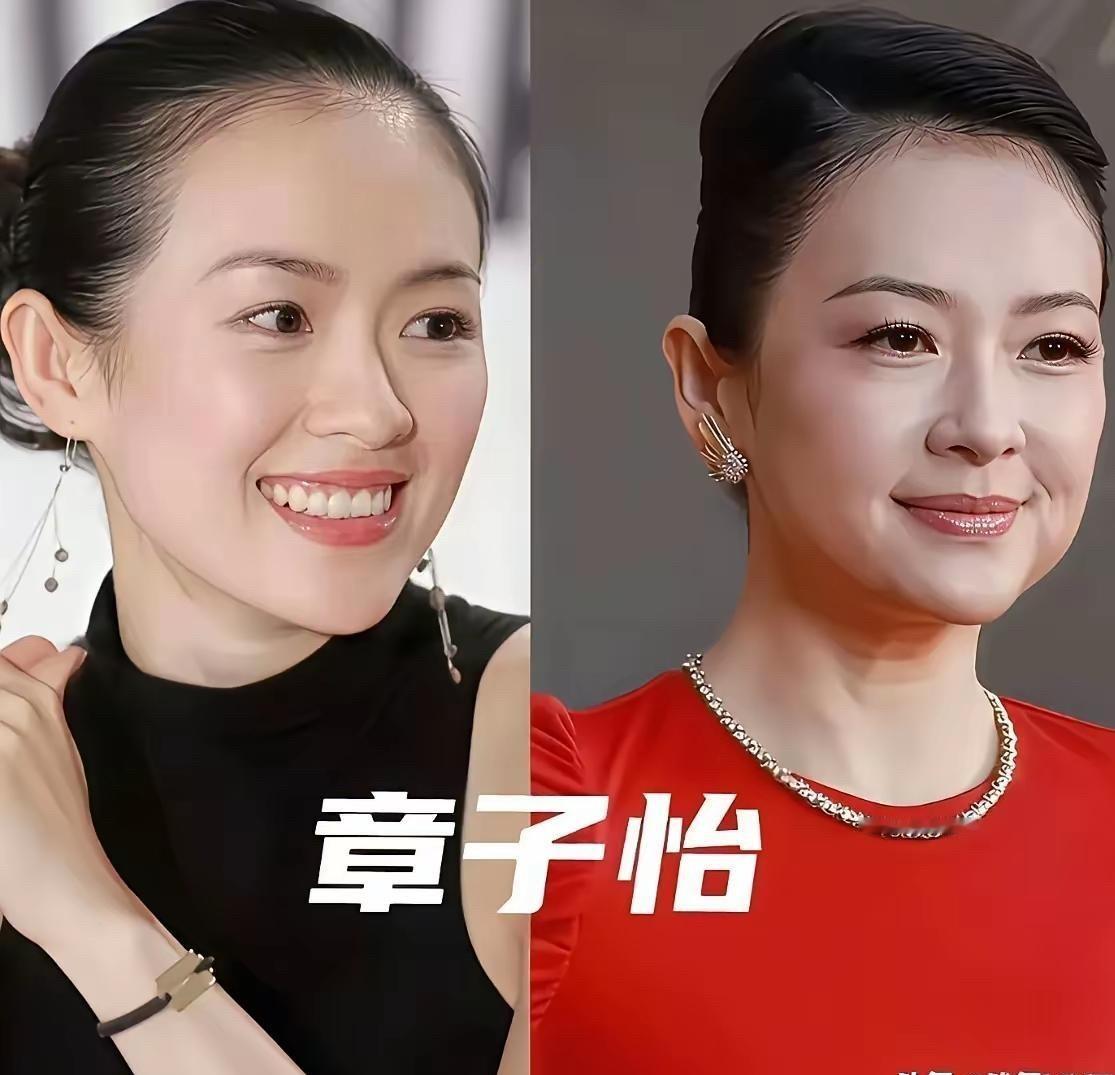 看到孙俪和章子怡现在的红毯生图，我才突然明白，内娱那些拼命靠医美维持少女感的女星到底有多可笑。很多人