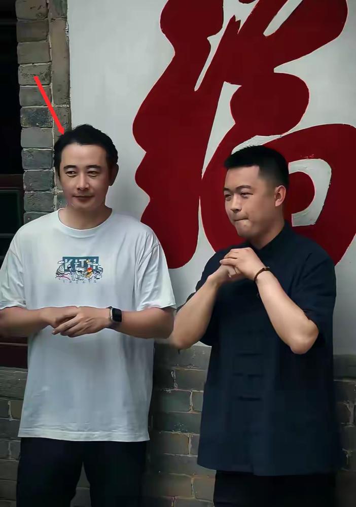 罗晋这发际线，简直快成地平线了！最近路透照曝出，他发际线后移得吓人，形象也随