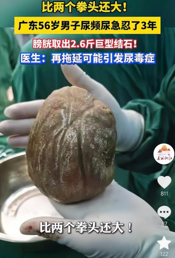 5月18日报道，广东徐闻56岁农民陈先生尿频尿急忍了3年，一直拖着没去医院，近期