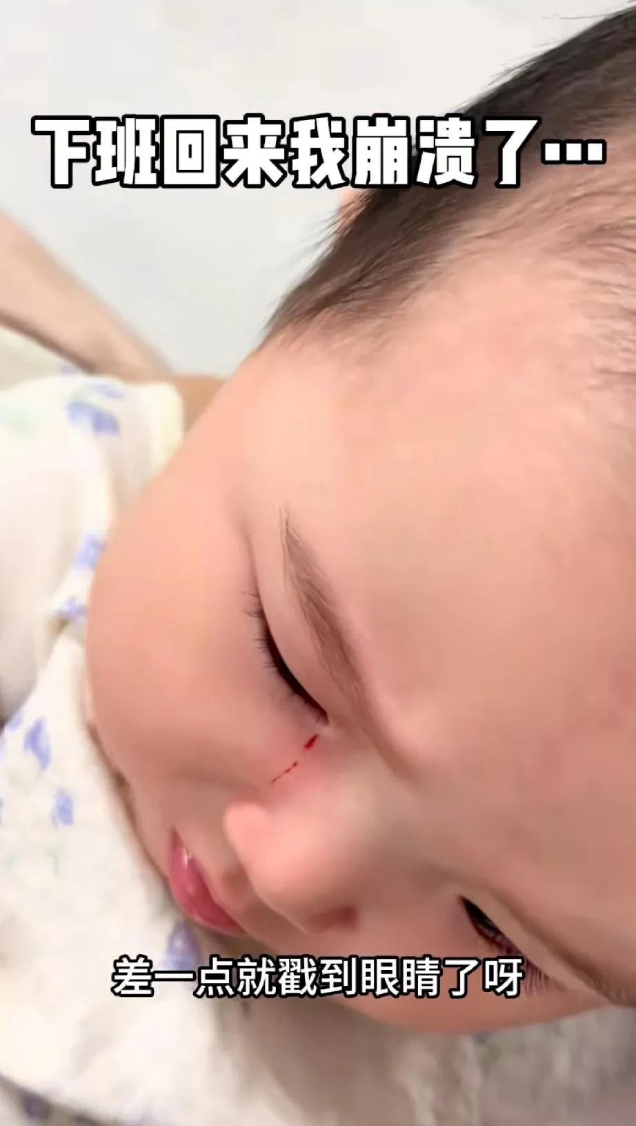 奶奶帮小两口带孩子，结果孩子在玩儿的时候眼睛边儿上被划了一下，小宝妈妈回来以后哭