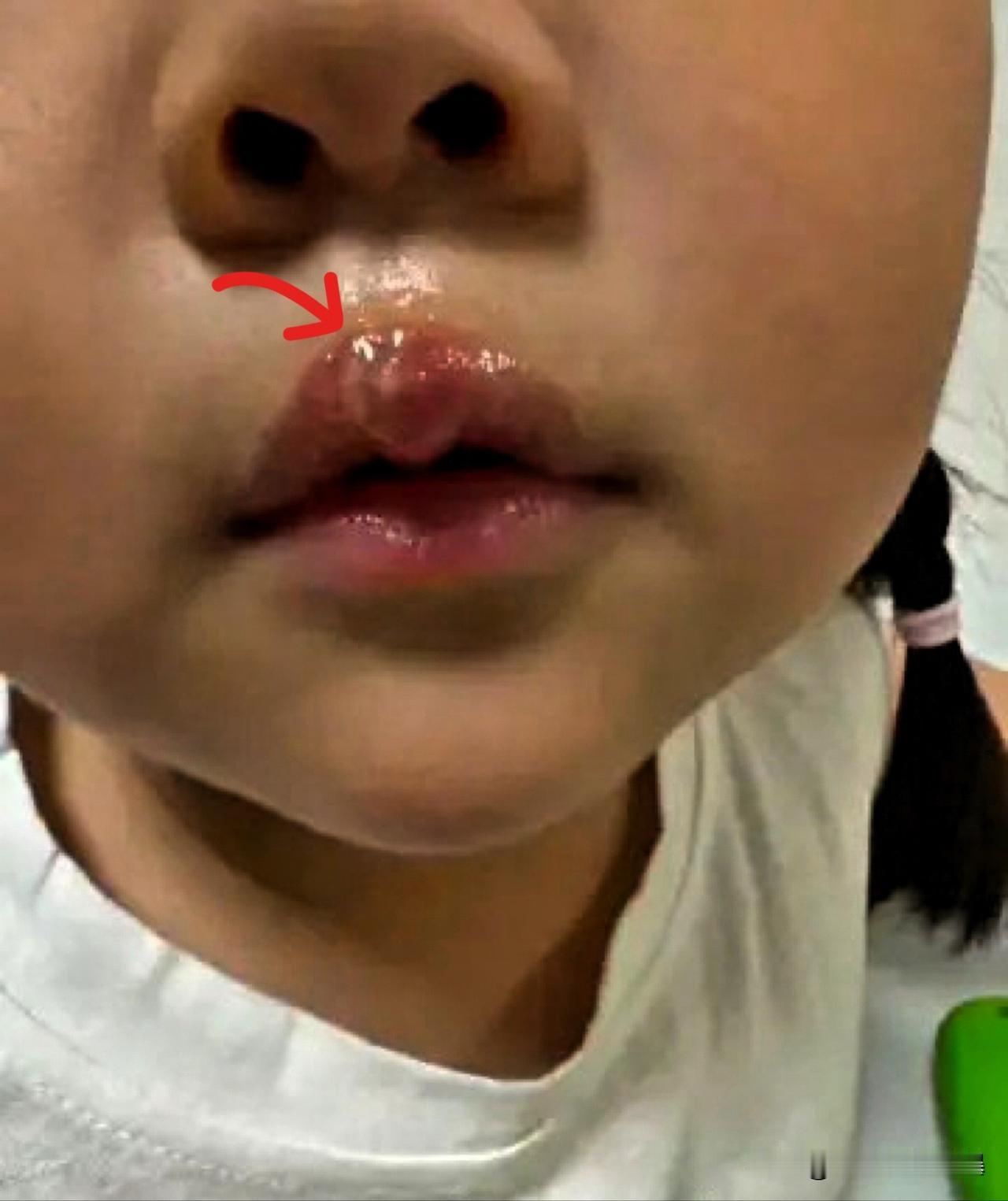 丰县幼儿园这事儿，看得人头皮发麻。那个用热熔枪烫孩子的女老师，固然狠毒得让人齿