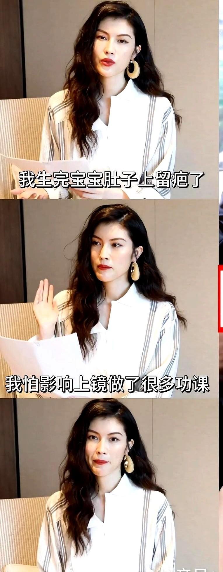 谁能想到，平时看着拽拽的陈伟霆，私底下竟然会被传出给何穗贴祛疤贴？这一幕要是真