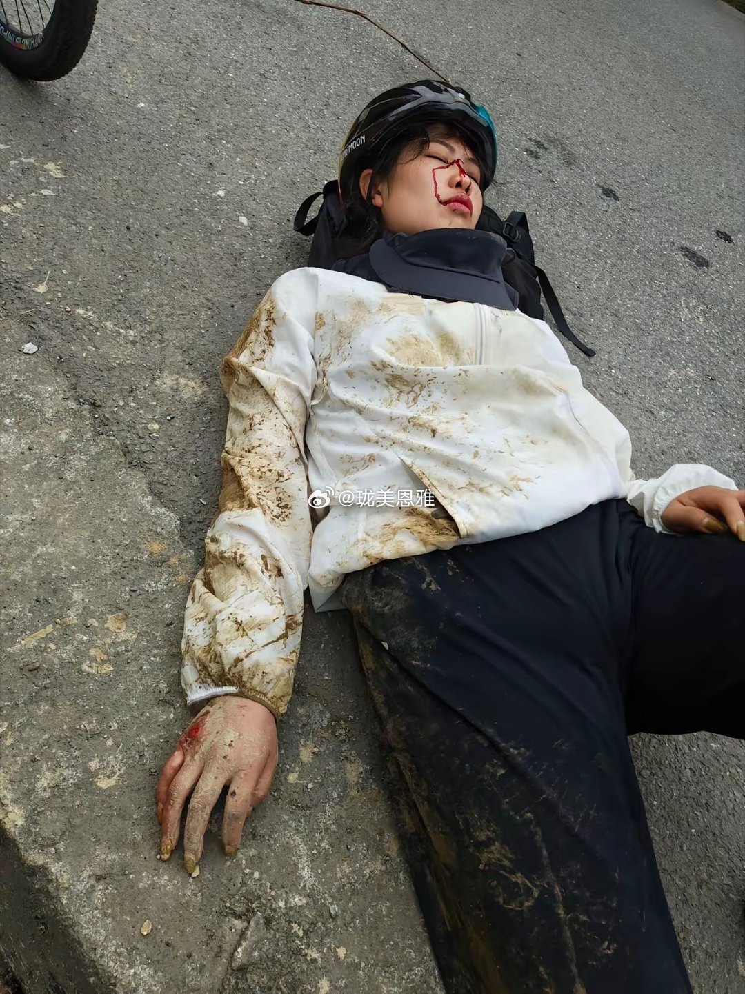 如果必有此劫，我认，不就是毁容吗