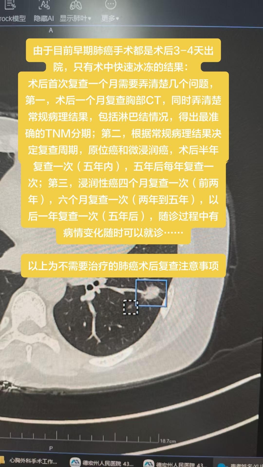 早期肺癌复查注意事项……由于目前早期肺癌手术都是术后3-4天出院，只有...