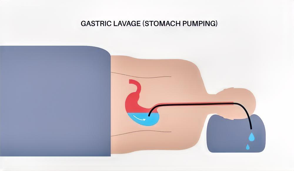 最近这碗糖水突然火出圈！不少人吃完头晕恶心被送医？医生赶紧提醒：有3个步骤要是做