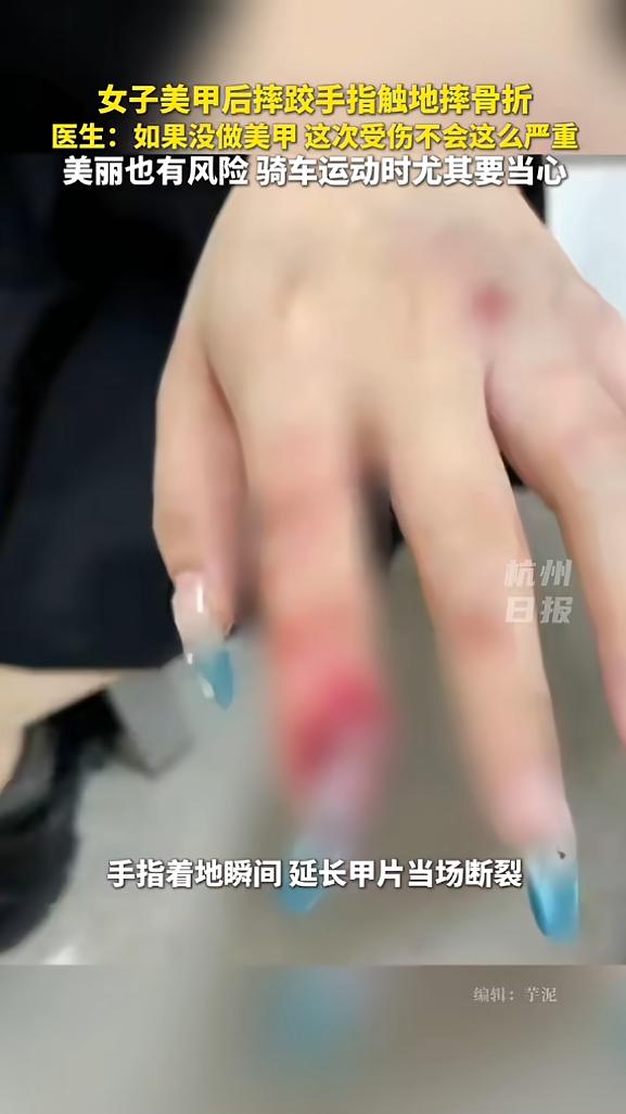 “悲剧还是发生了！”近日，浙江杭州，一女子为了让手指显得更修长，在做美甲时特意延