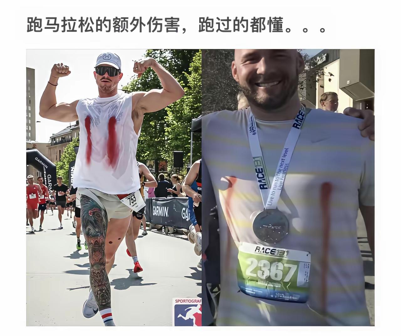 好家伙，这马拉松伤害可太大了[捂脸哭]