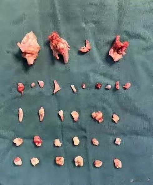 湖南长沙，一18岁姑娘跳个操竟疼到直不起腰，就医后查出的结果让所有人惊掉下巴！下