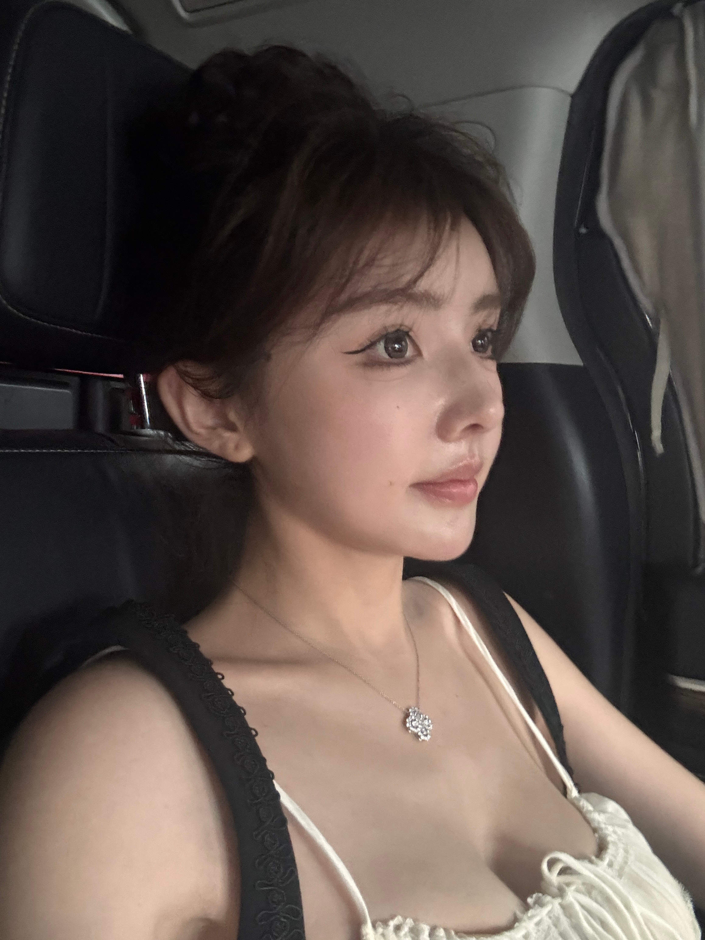 自然了就是这个医生做的鼻型所有人都得切鼻翼缘不然都会显得下垂我之前鼻子就没有这么