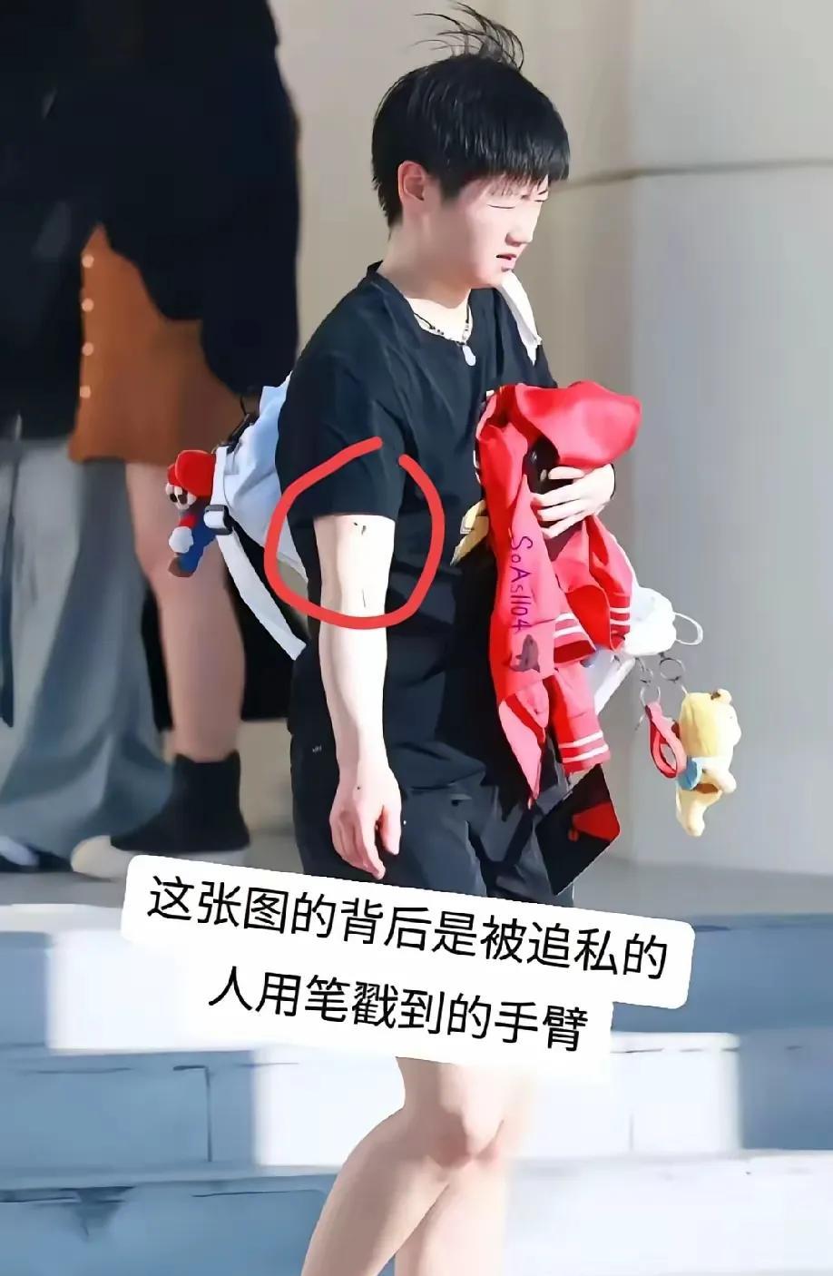 据说这是球迷搭讪莎莎，想让莎莎签名，被莎莎拒绝后，用笔在莎莎手臂上划了一下，看莎