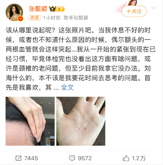 我天，看图片还挺严重的，太多艺人为了在荧幕前保持身材身体出现问题了，还是健康最重