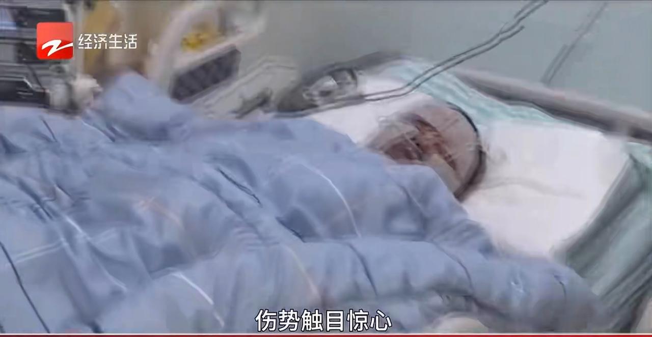 安徽怀远的张先生，怎么也想不到一次平常的出行会变成一生的噩梦。那天他像往常一样，