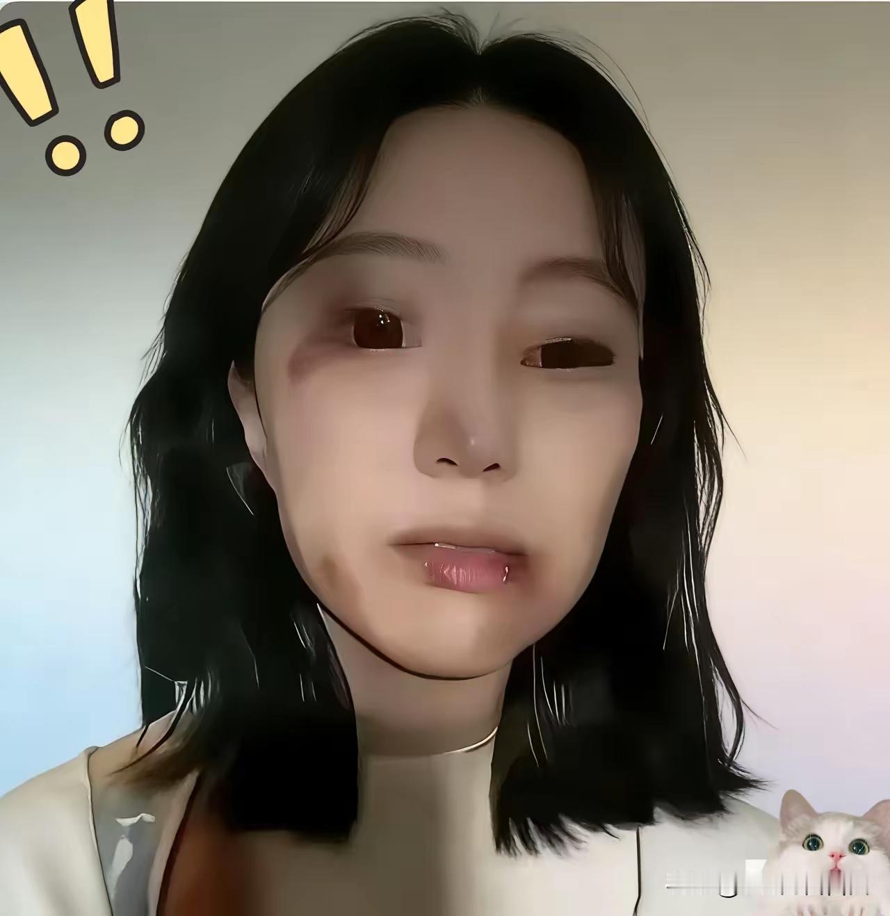 这女子不值得同情，虽然她被打了满脸伤！江西一女子，到市场去买鱼。挑好鱼后，提