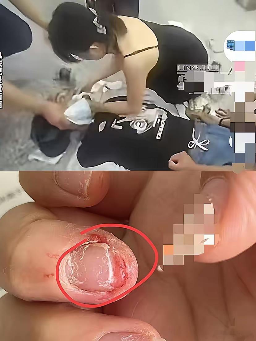 我老公不明白，只是急救了一个病人，这护士为啥一下子就火了？我直接甩话：你试试用嘴