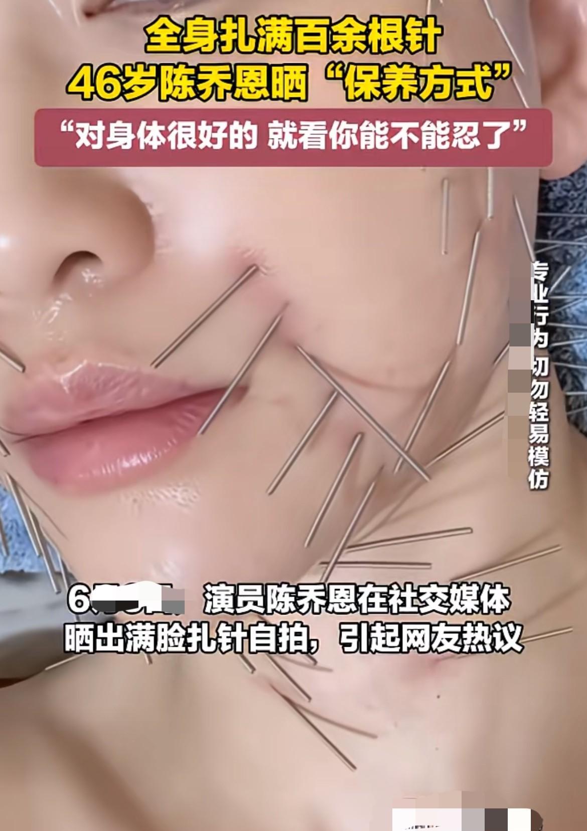 太吓人了吧，陈乔恩真够狠的，只见她全身扎满百余根针，开始以为是治病呢，可是看清楚