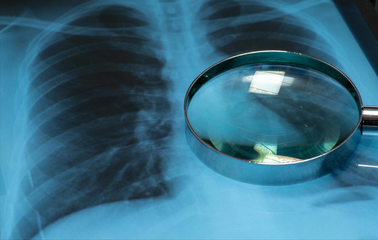 很多人在犯着同样的健康错误，不改变习惯的话很容易导致肺病，第一，憋气锻炼肺功能