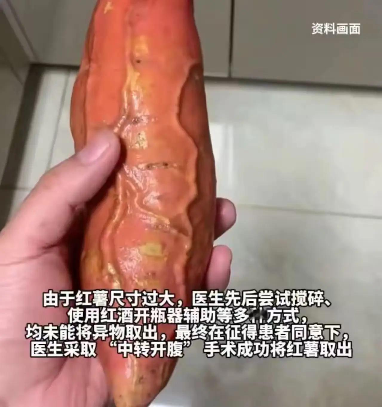 四川成都，一位61岁的大爷深夜干了件让人哭笑不得又心疼的事——他把一整根红薯塞进