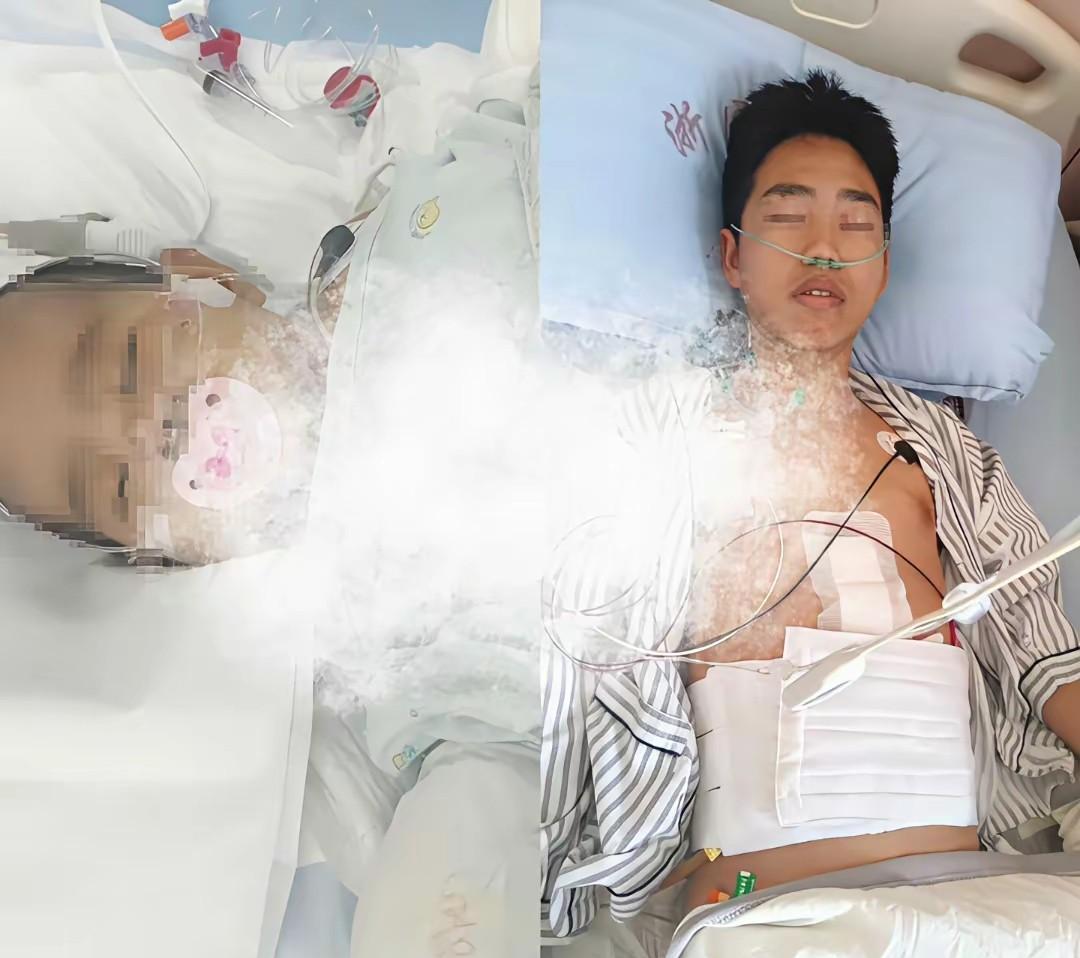 几个月大的女儿需要肝移植，00后爸爸毫不犹豫的割肝救女。手术非常顺利，宝宝对来看