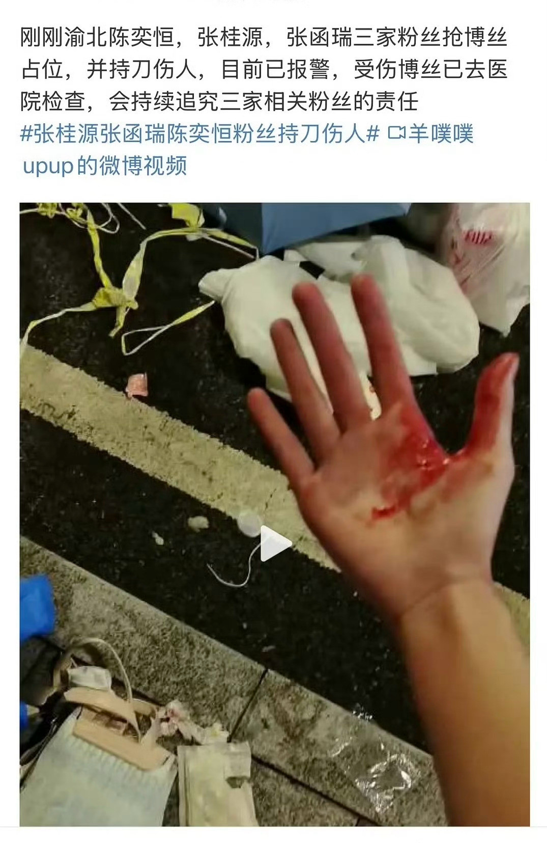 为了追星粉丝都敢持刀伤人了……🌚​​​