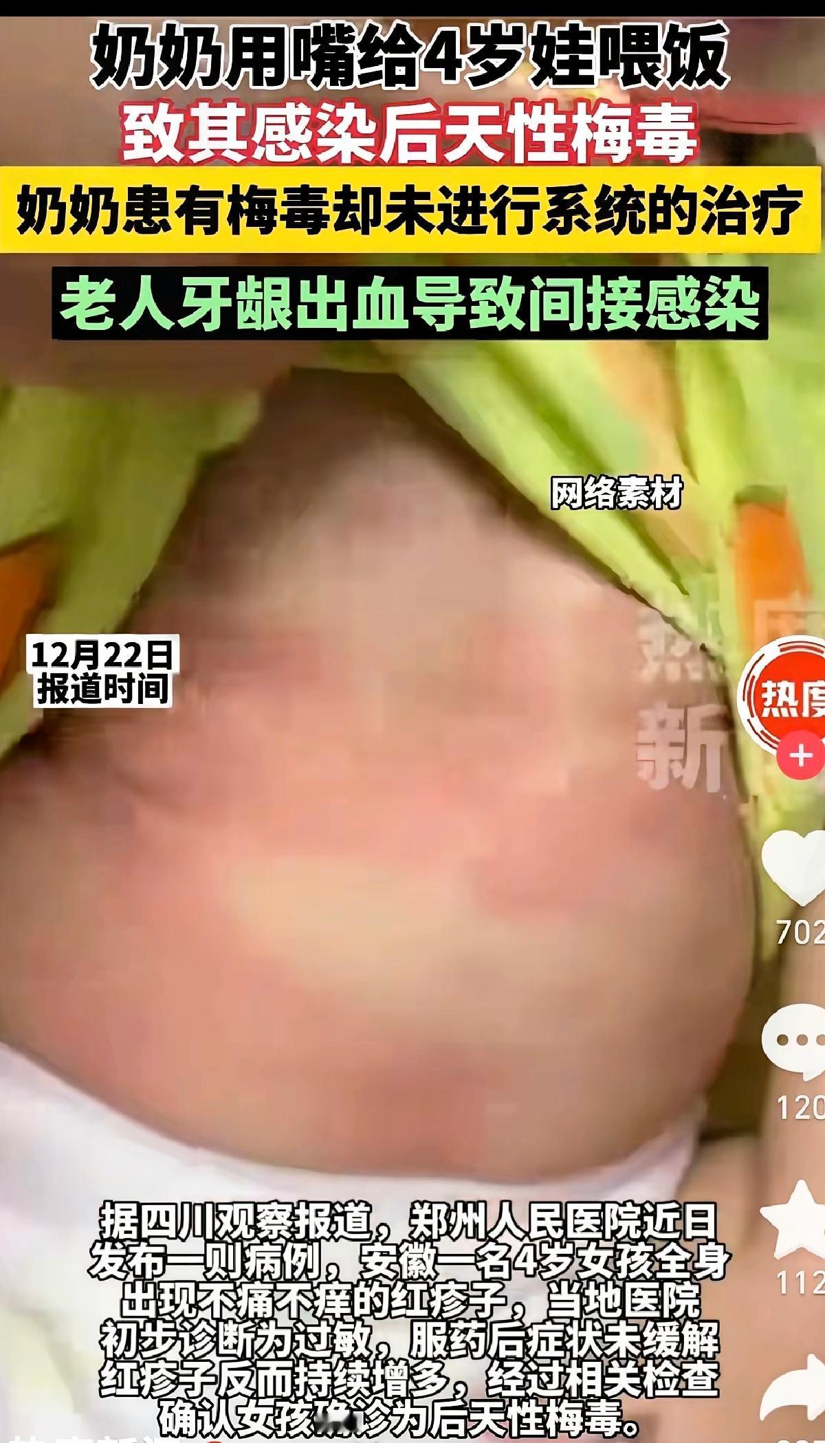 天杀的奶奶哟！4岁女娃竟被喂饭喂出梅毒，这事真的能把人逼疯！都什么年代了，还死守