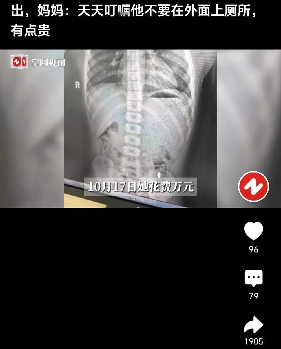 一男孩大便,妈妈千叮万嘱只能在家上厕所,这背后原因太惊人!原来,10月