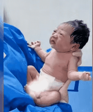 救命！这家娃刚出生就长这样，医生都笑疯了，刚生完娃推出来，我第一眼看到这小家伙直