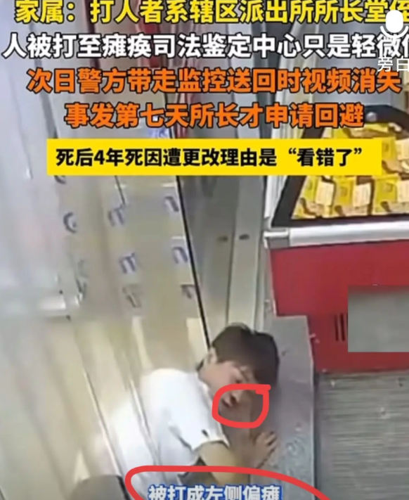 不能停，不能停支持受害者姐姐看了才知道下手真狠……    这是有多大的仇