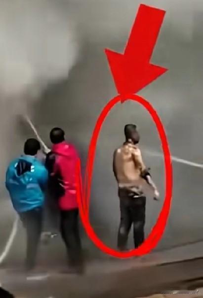 男子不顾自身安危多次冲进火场救妻子，皮肤烧焦脱落，眼睛依然在盯着火场里又是一个