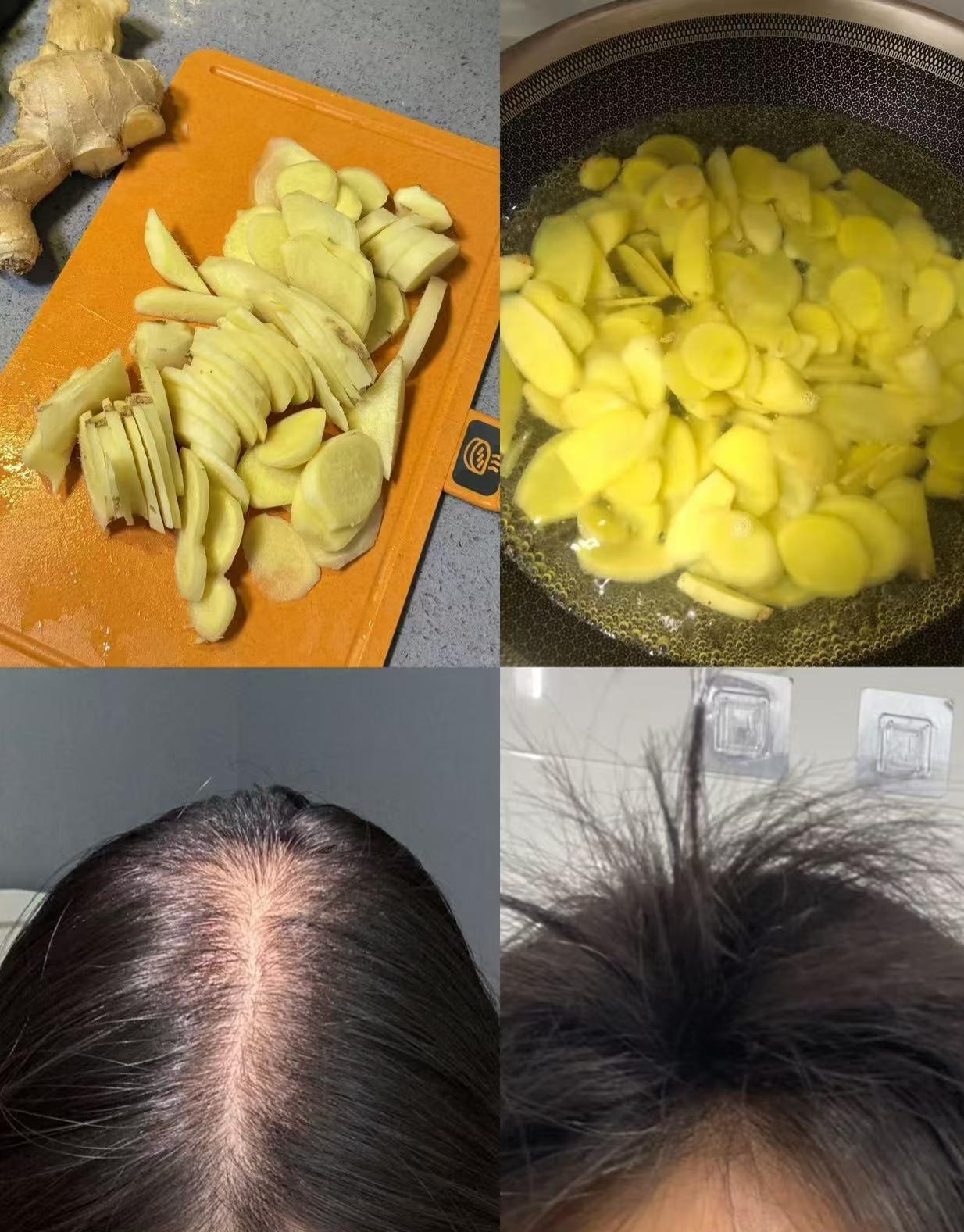 掉头发其实是脾胃在“报警”！中医提醒：越想变强，头发越掉？你是否发现，自己越是