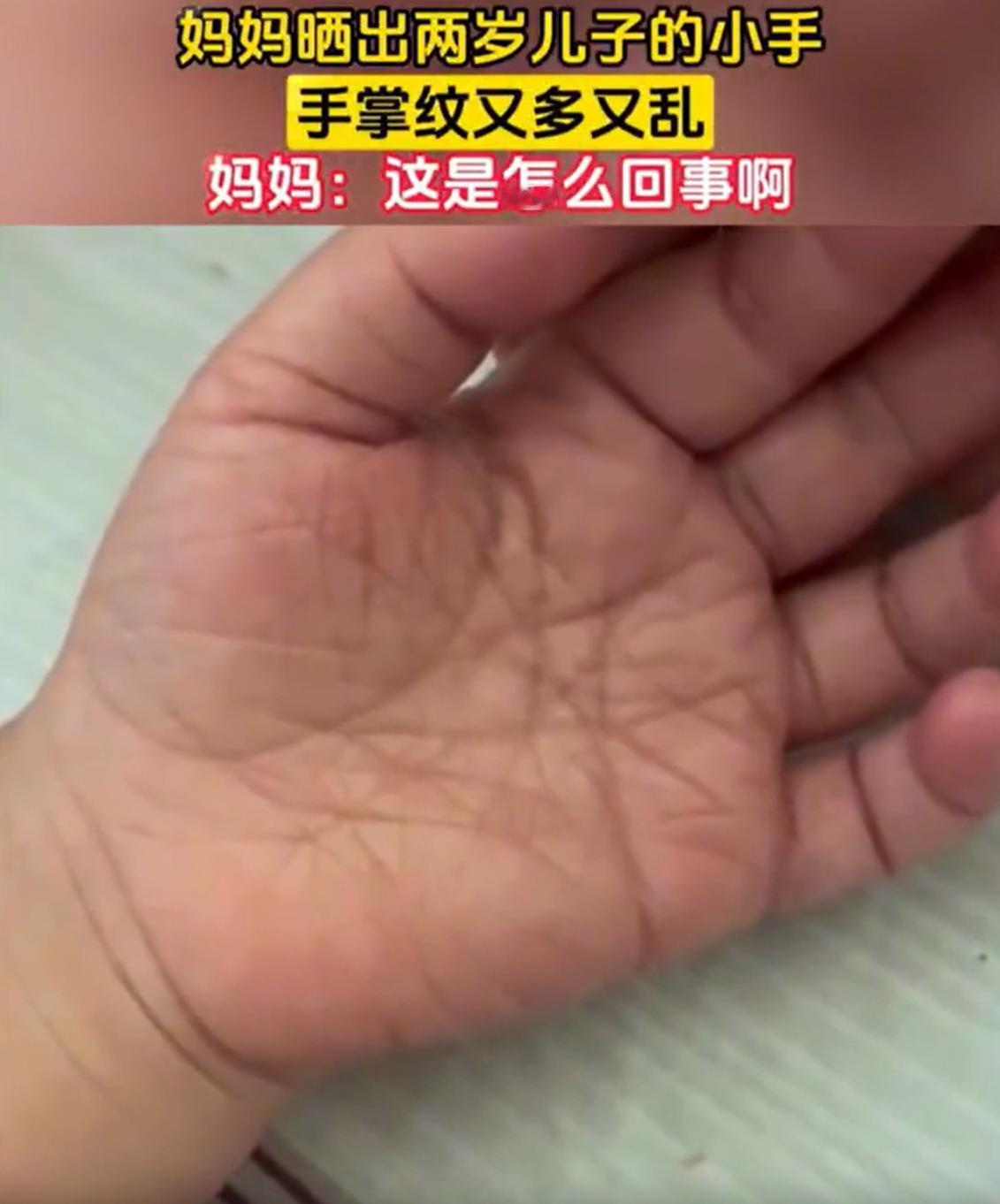 “这是怎么回事？”一位宝妈在家照顾孩子时，突然发现两岁儿子的小手上面的掌纹又多又