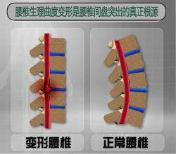缓解腰酸的六大技巧