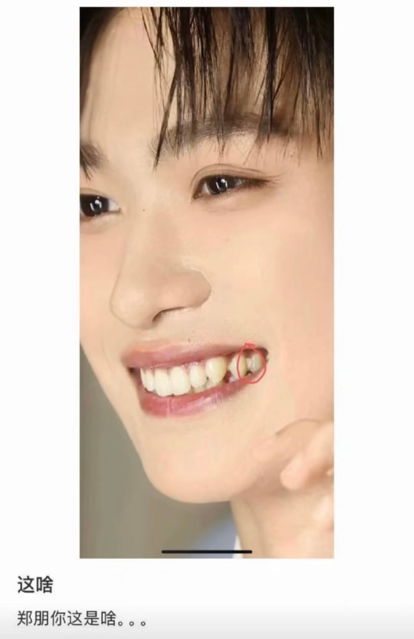 啊？原来戴牙套会有这么严重的口臭问题啊？我也没戴