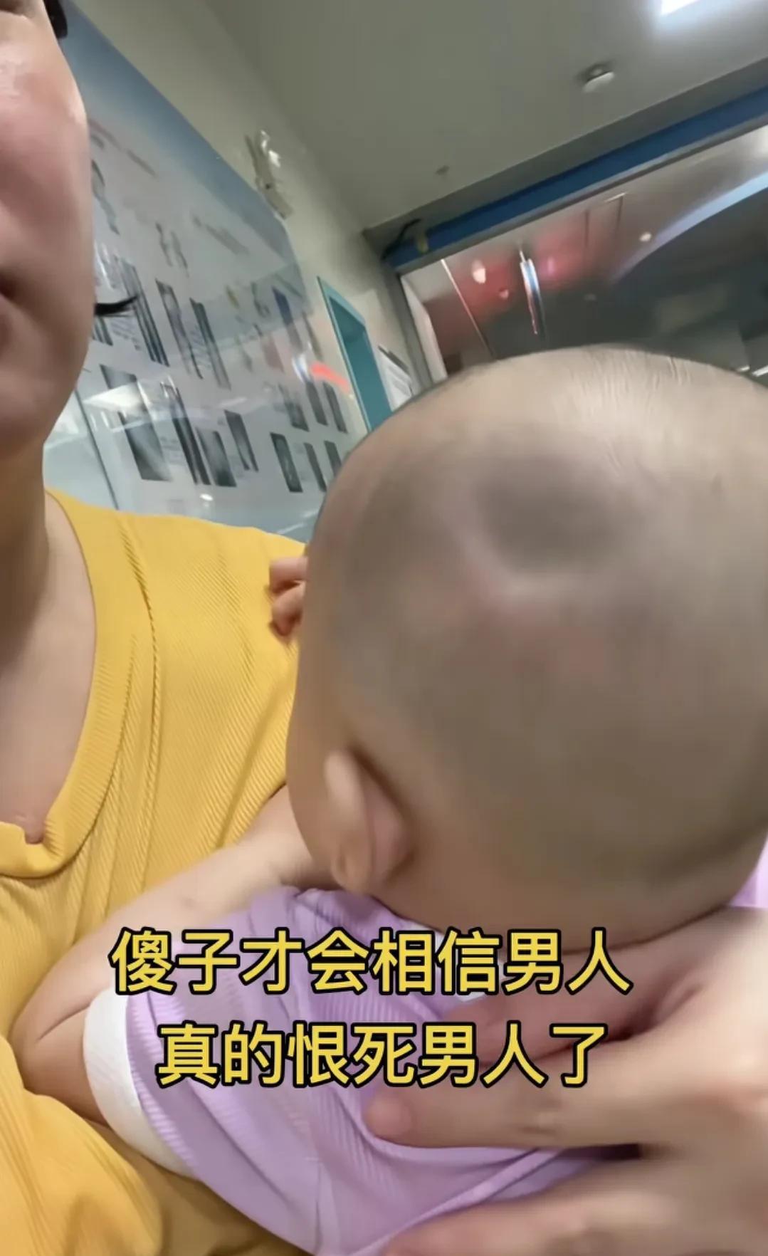 新手爸爸带孩子，看看这孩子头被摔一个大坑。已经去急诊了，说骨折了[哭哭]这么小