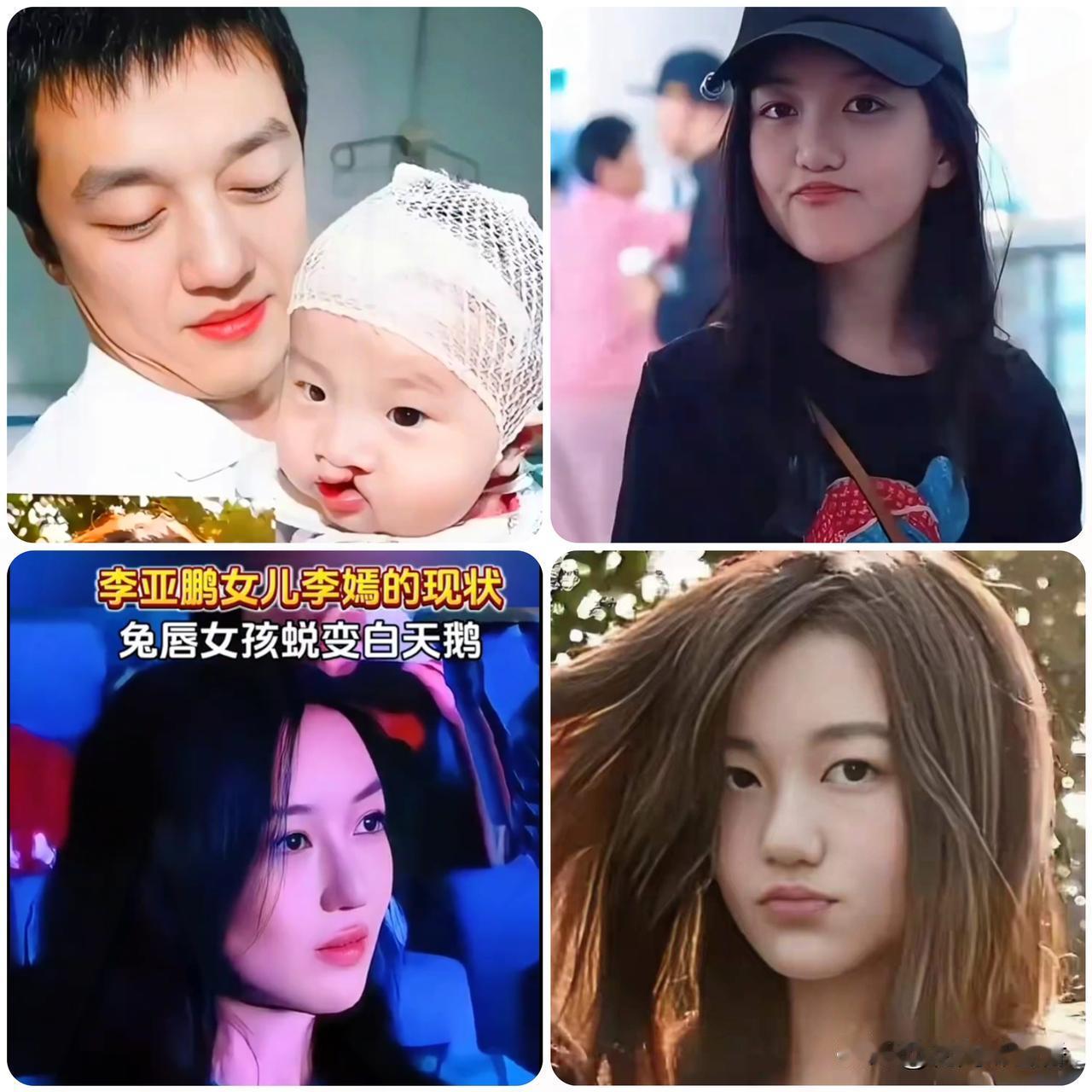 18年磨一剑！李嫣终迎手术收官泪崩，窦靖童守护太戳心，最坚实的后盾李嫣