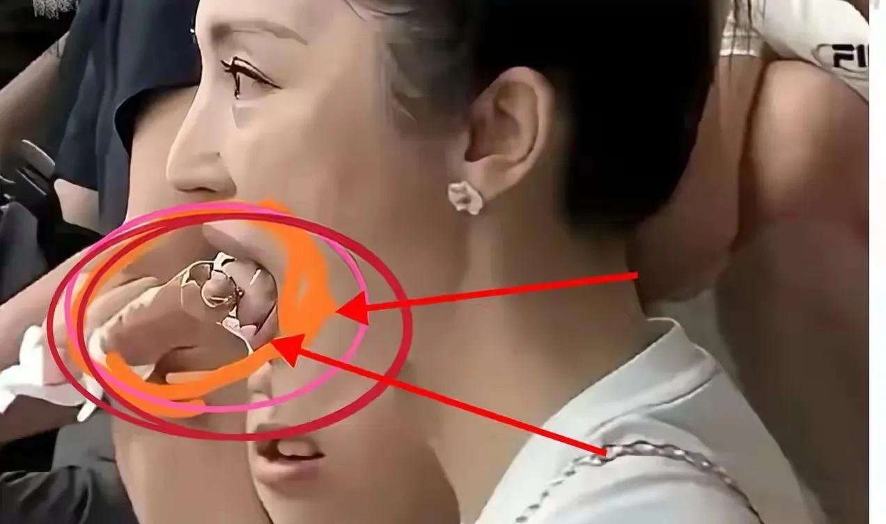 这是受的什么罪呀？这舌头还能吃东西吗？
