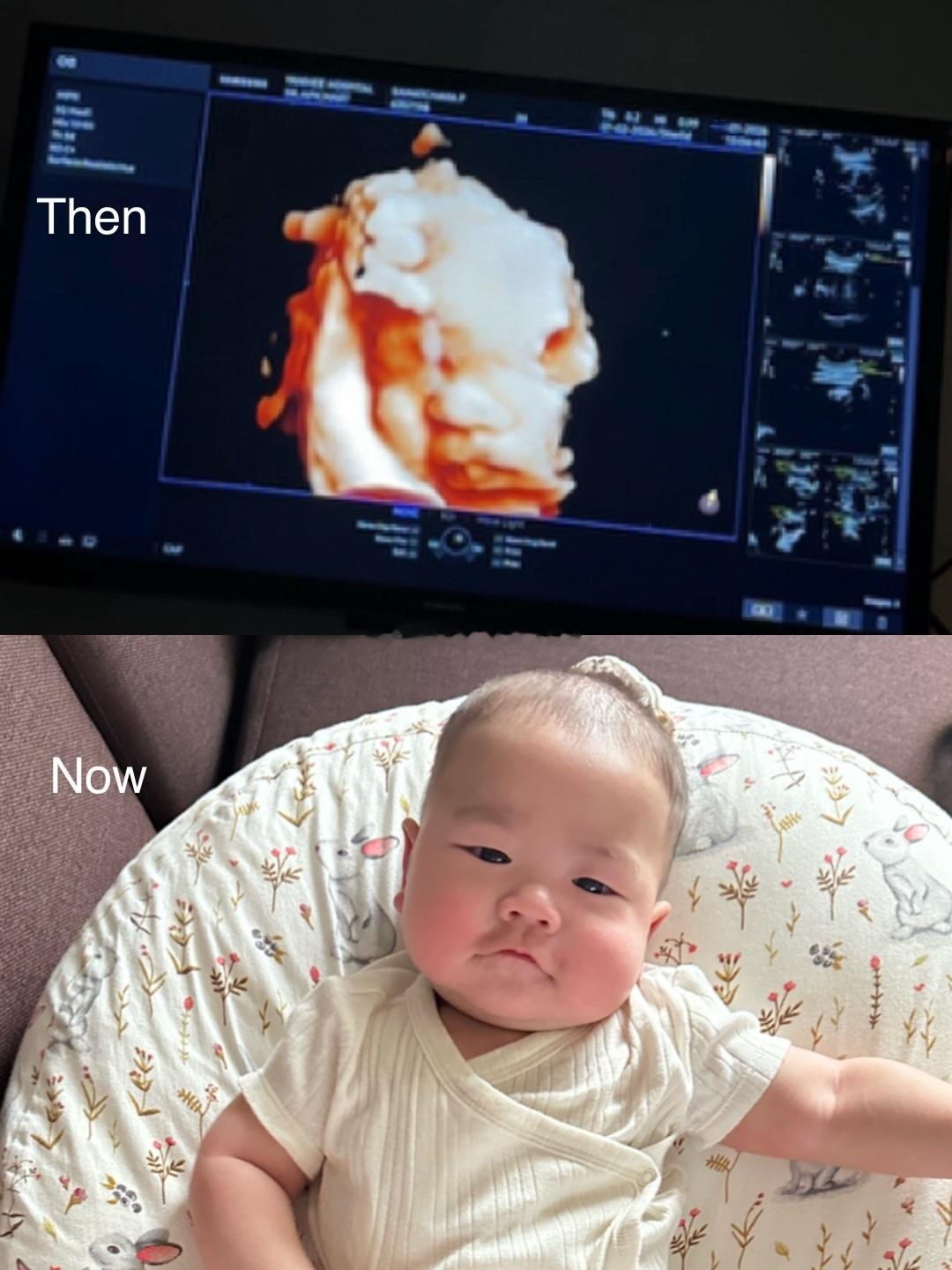 好孕接力棒投稿接好孕🧚♀️Then：还在肚子里看4D。Now：已经出来玩情