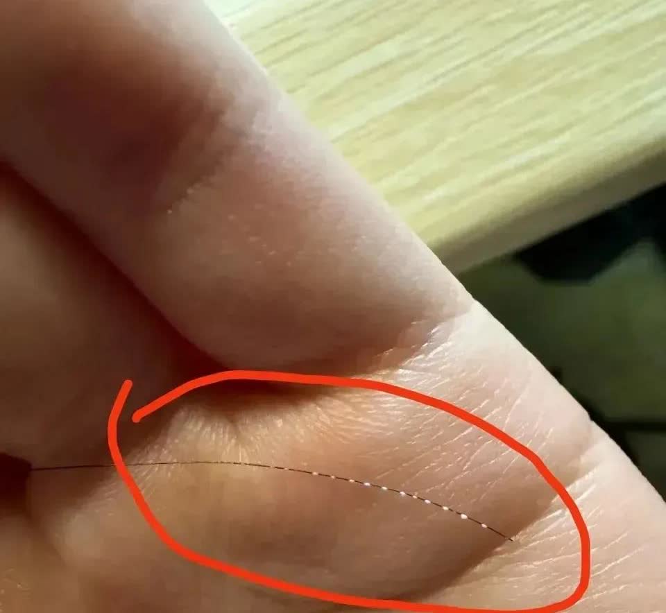 贵州，一名女子在梳头时，突然掉落了一根头发，女子无意间发现，在这根头发上面，粘着