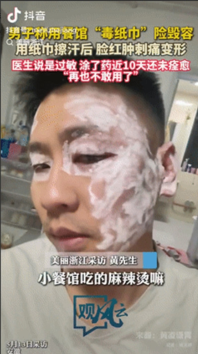 “太吓人了!”近日安徽，小伙去小饭馆吃麻辣烫，因为出了一些汗，就用店里的纸巾纸