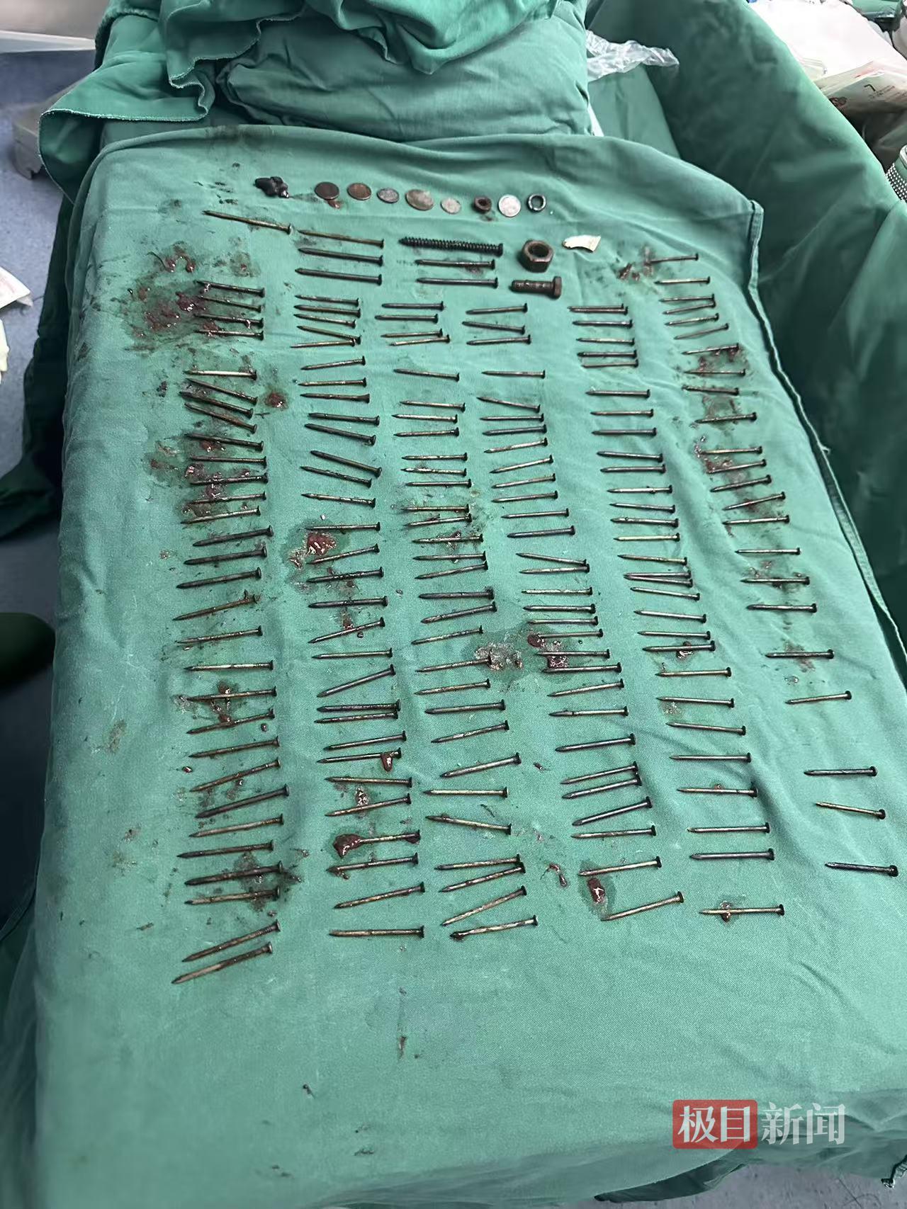 “太可怕了！”云南一名男子患有精神病，而且长期身体不适，反反复复肚子疼、恶心反胃