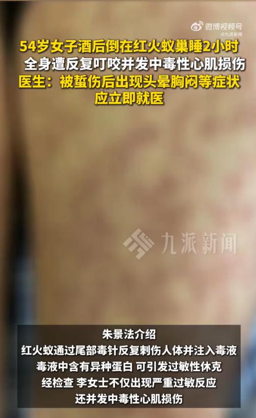 泉州54岁的李女士怎么也没想到，一次酒后失态，会让她在"鬼门关"前走了一遭。