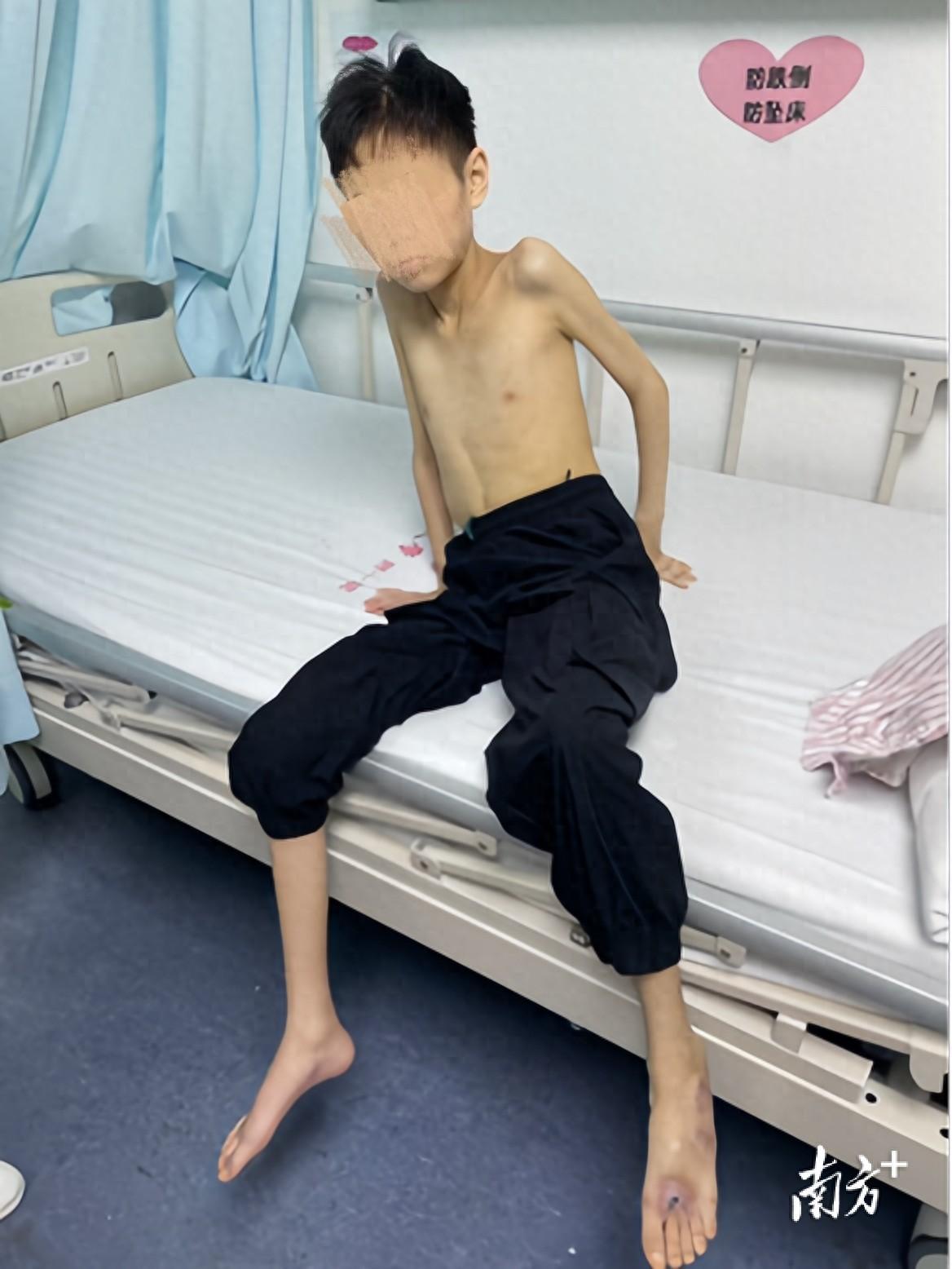 悲剧还是发生了！7月11日南方+客户端报道，江西，一名17岁男孩，整整六年不停反