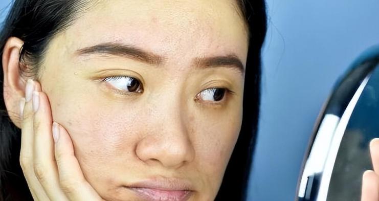 人有没有糖尿病，看脸就知道？提醒：血糖高的人脸部常有4种变化，别等并发症才后悔