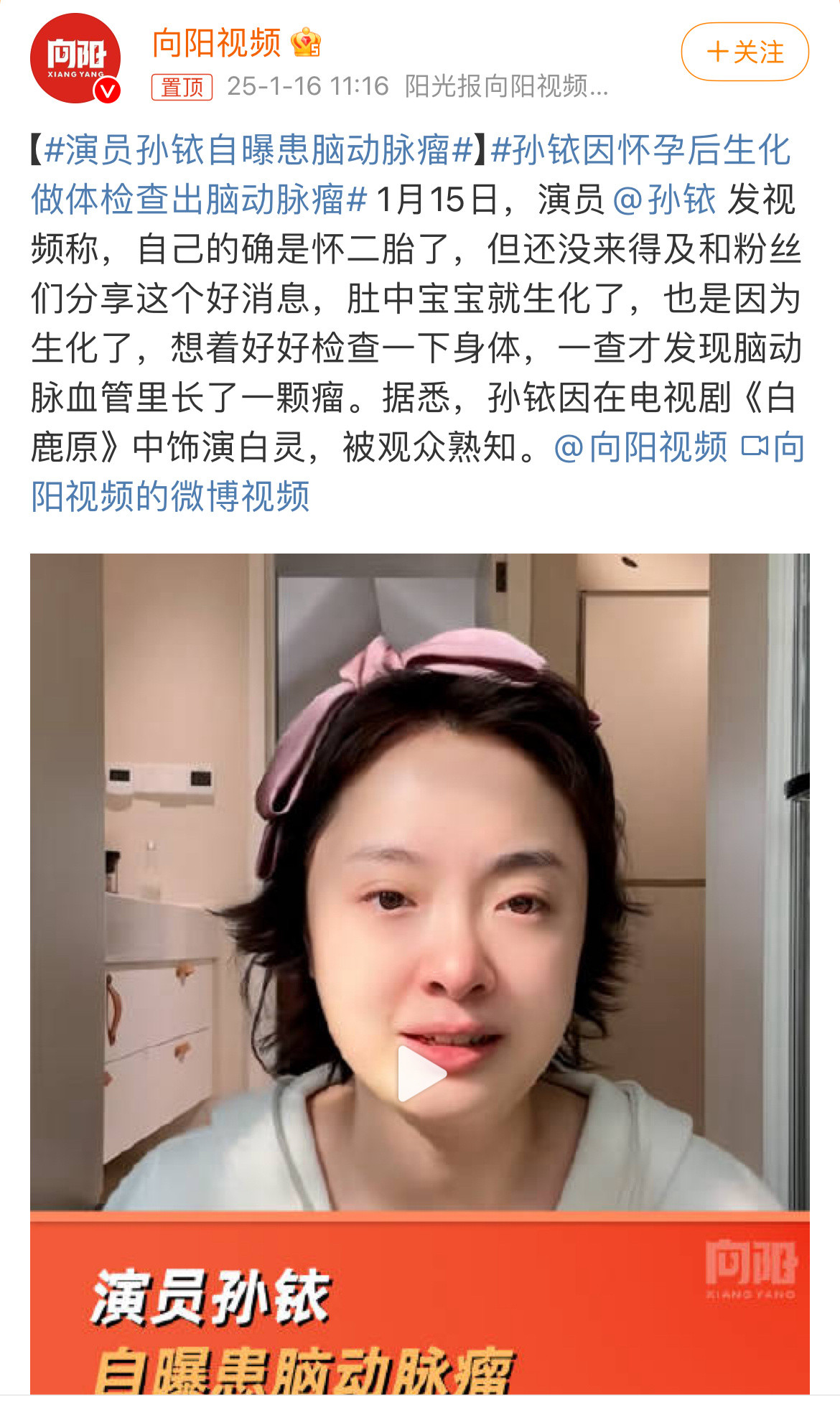 孙铱因怀孕后生化做体检查出脑动脉瘤孙铱在备孕二胎期间发生了生化妊娠，生化妊娠是