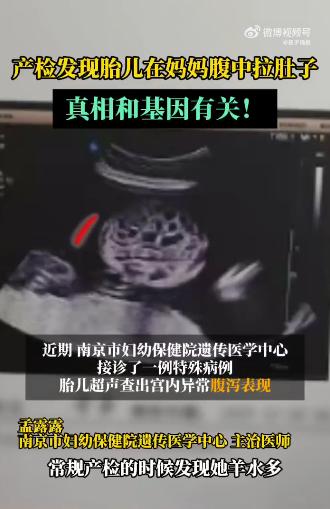 “太揪心了！”江苏南京，一位29岁的孕妈小文，在孕24周+3天时像往常一样去医院