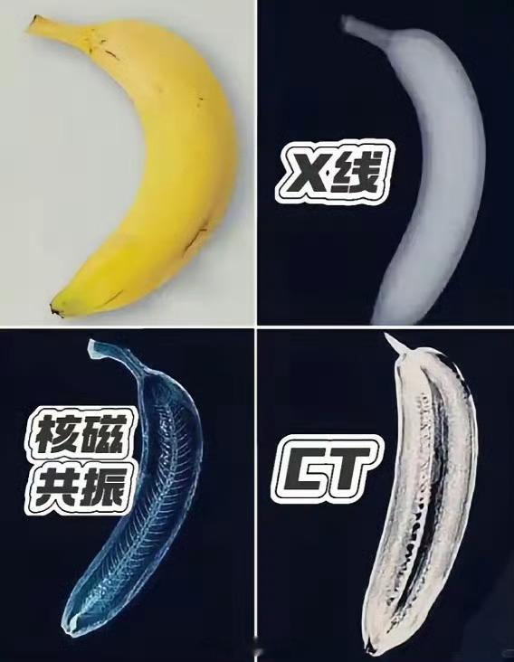 一张图教你看懂核CT、核磁共振、X光。