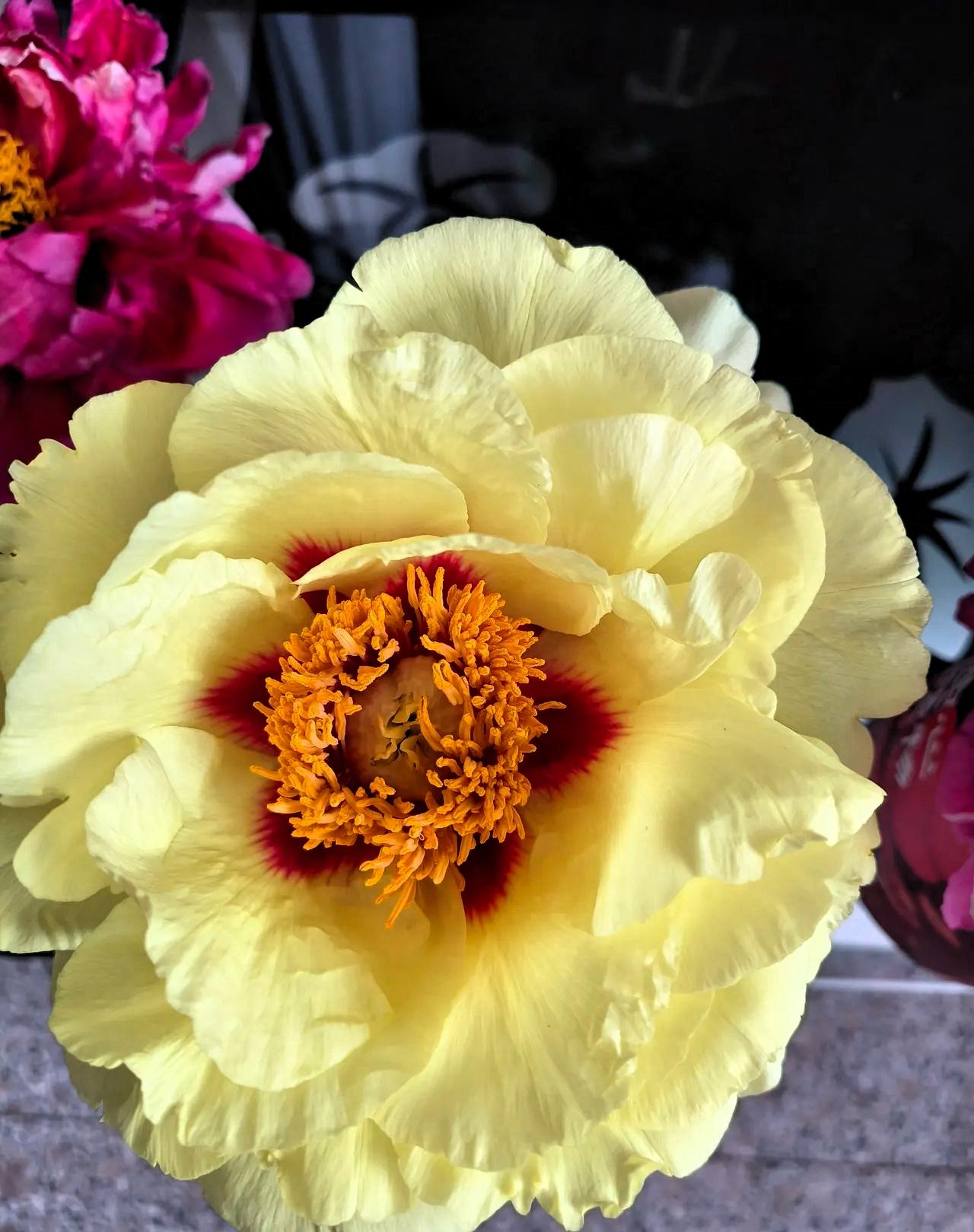 别染发，别染发，别染发4月15日，主持人尼格买提晒出眼部严重肿胀的照片，简