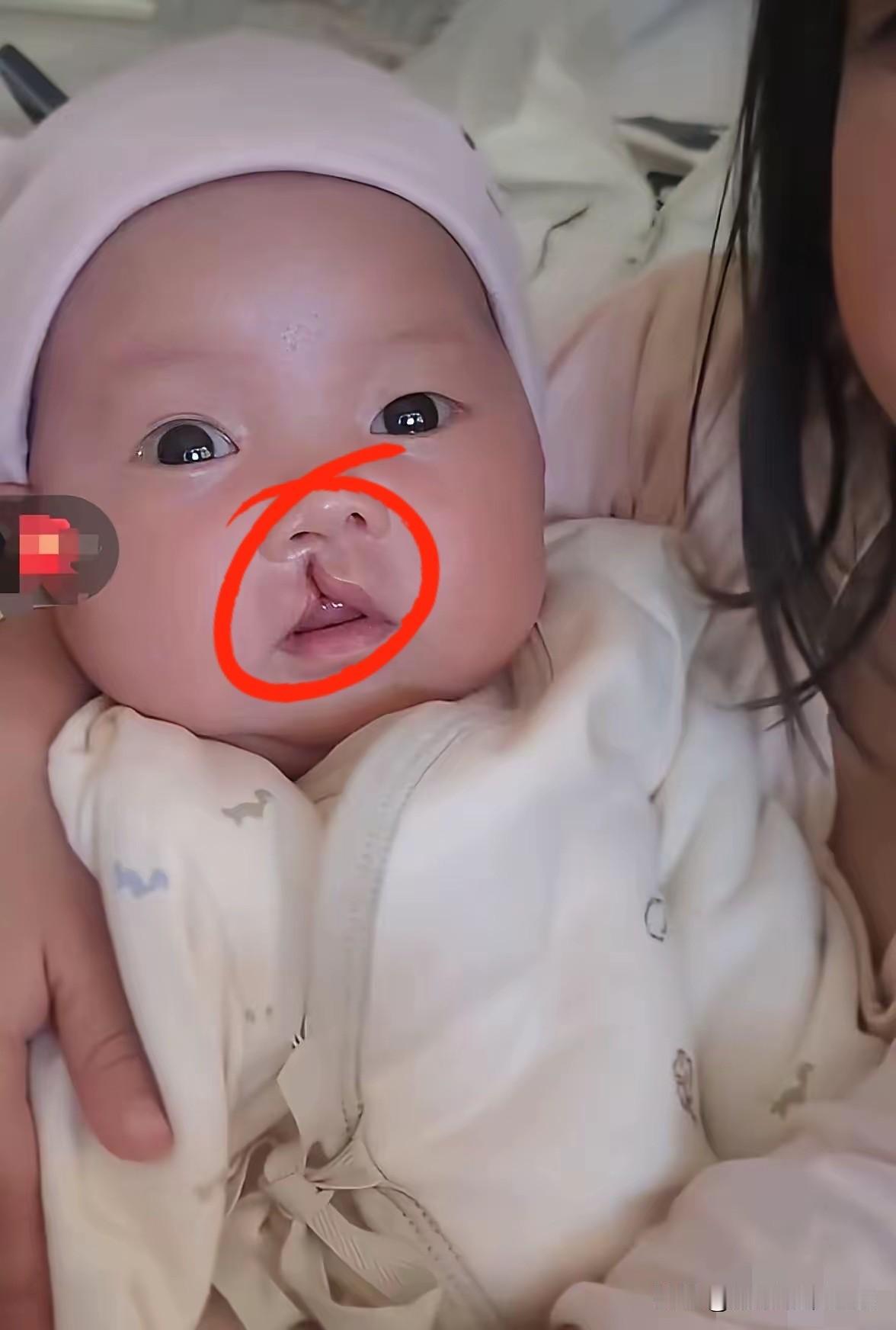 看着这孩子手术前后的照片，心里真是一哆嗦，这变化太大了，简直就是给了第二次生命。